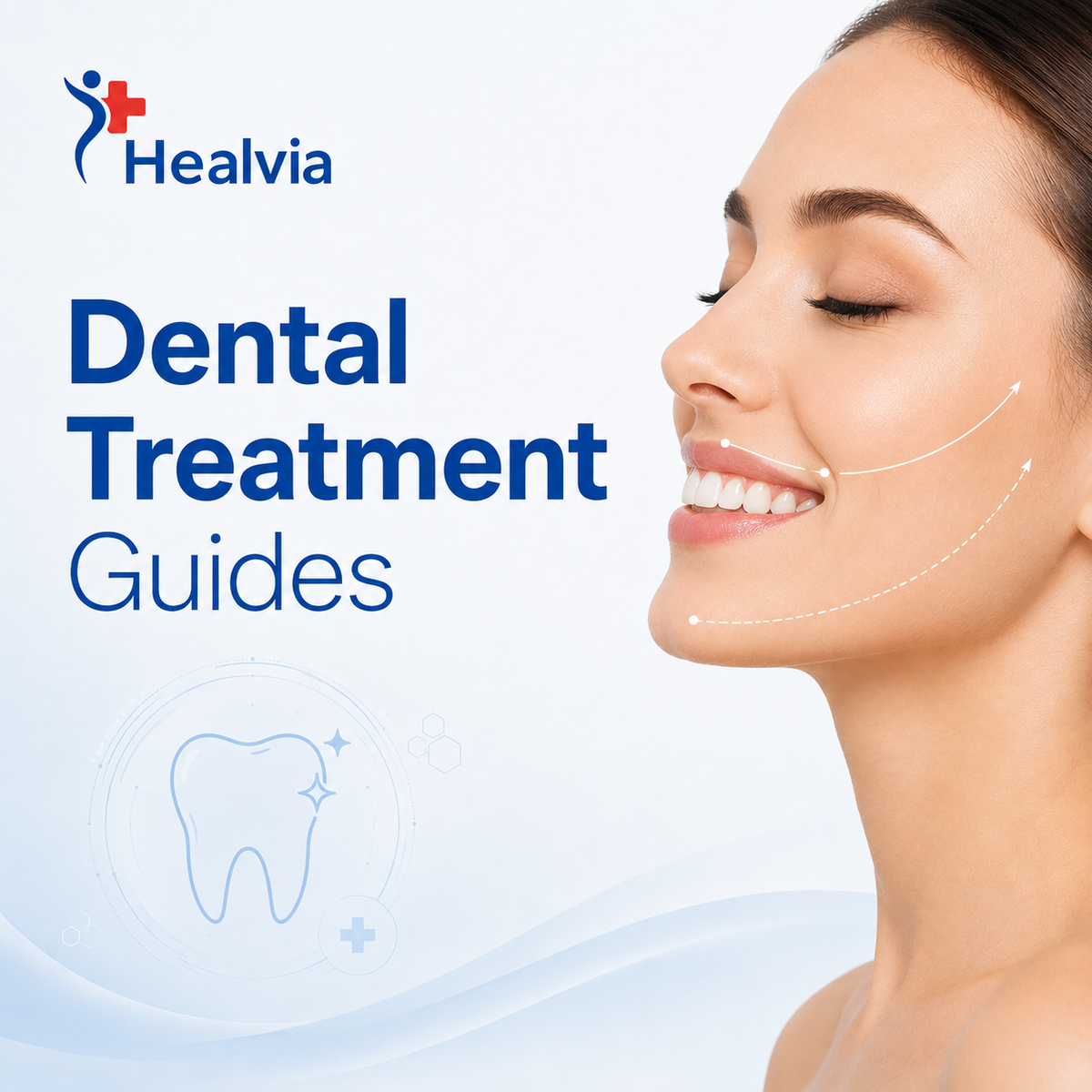 Dental Treatment Guides