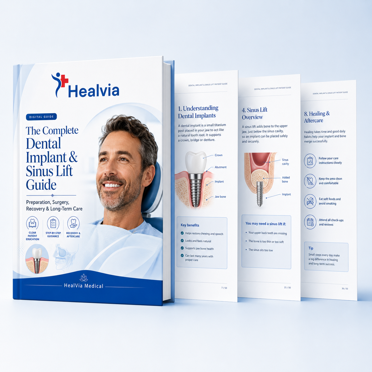 Interior page preview from the HealVia dental implant patient guide